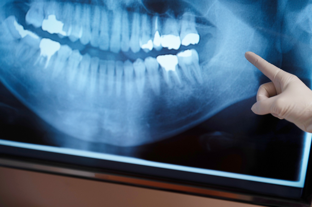 診断（カウンセリング）